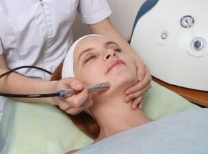 Laser rejuvenation of the face