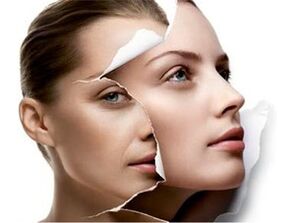 Skin rejuvenation