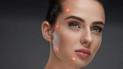 What is fractional skin rejuvenation