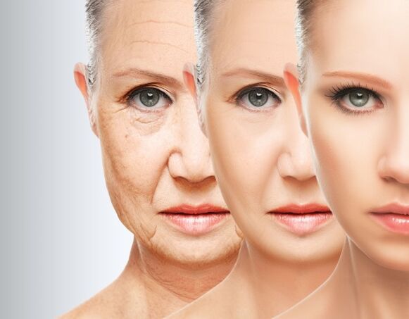 The process of eliminating facial wrinkles thanks to plasma rejuvenation