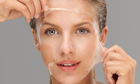 Deep peeling enhances skin regeneration processes, rejuvenating it